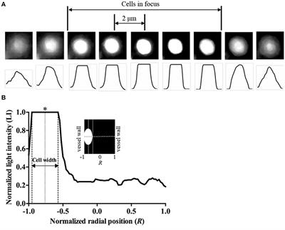 Near-Wall Migration Dynamics of Erythrocytes in Vivo: Effects of Cell Deformability and Arteriolar Bifurcation